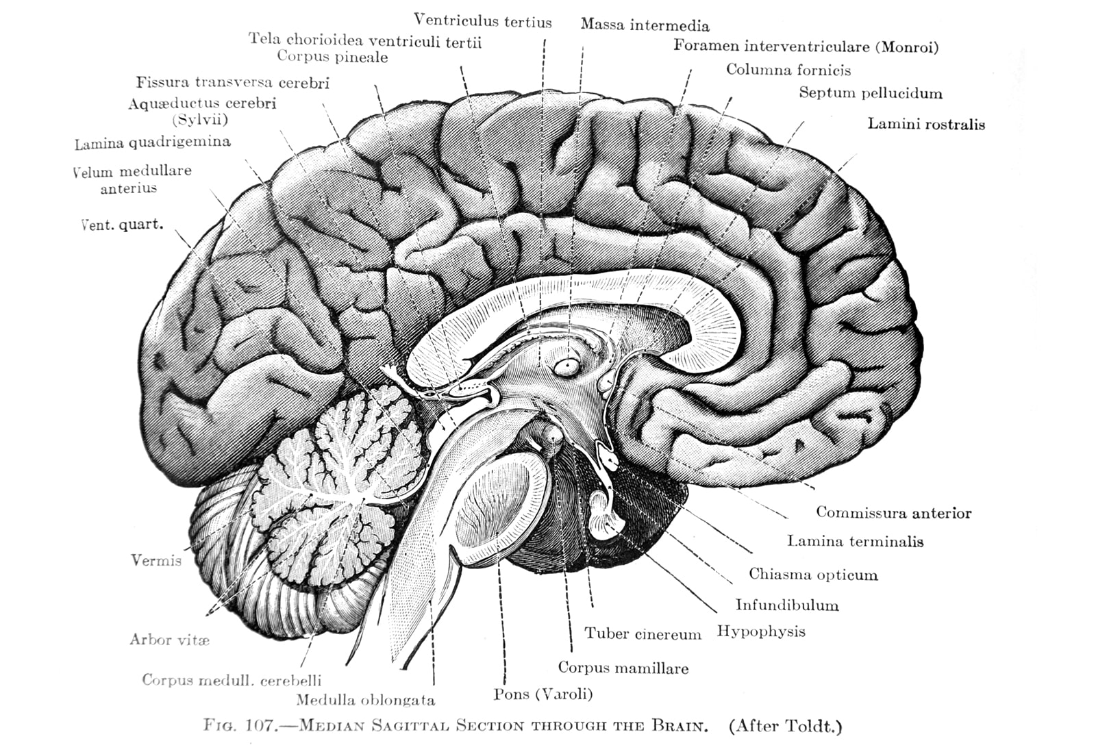 Subcortical vs Cortical Processing Feature